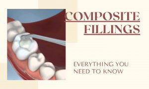 composite fillings